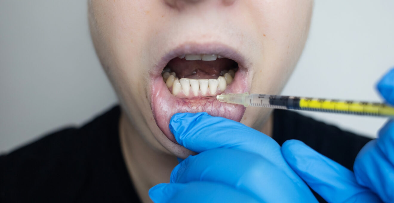 récession gingivale.jpg